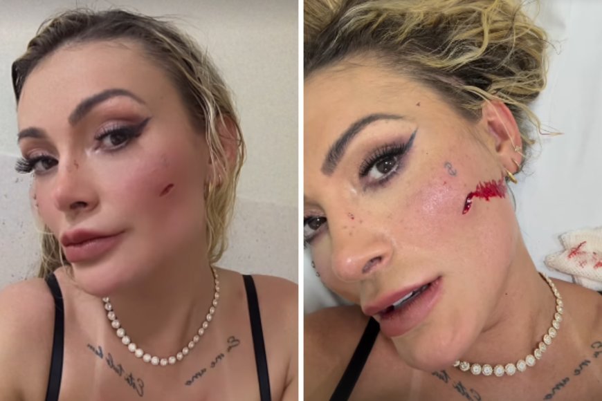 Andressa Urach se envolve em briga e vai parar no hospital - Veja o que aconteceu!